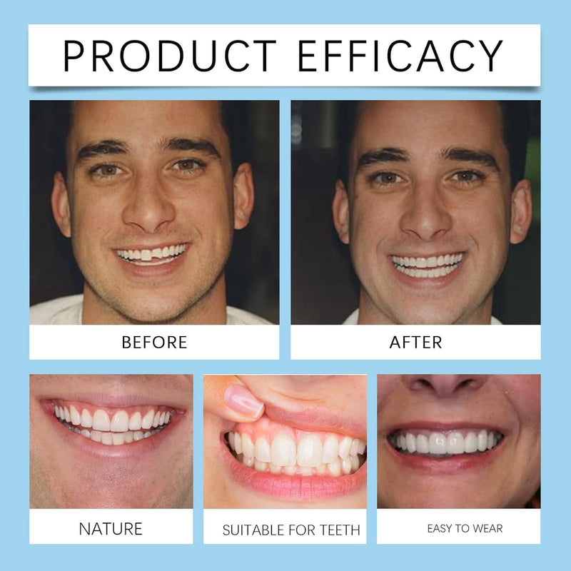 [Australia] - Bikenda Silicone Dental Prostheses Prosthesis Modification Set Silicone Dental Prostheses, Dentures Prosthesis Complete, Clip-on Dentures, Denture Silicone Reline Kit Temporary Dentures 