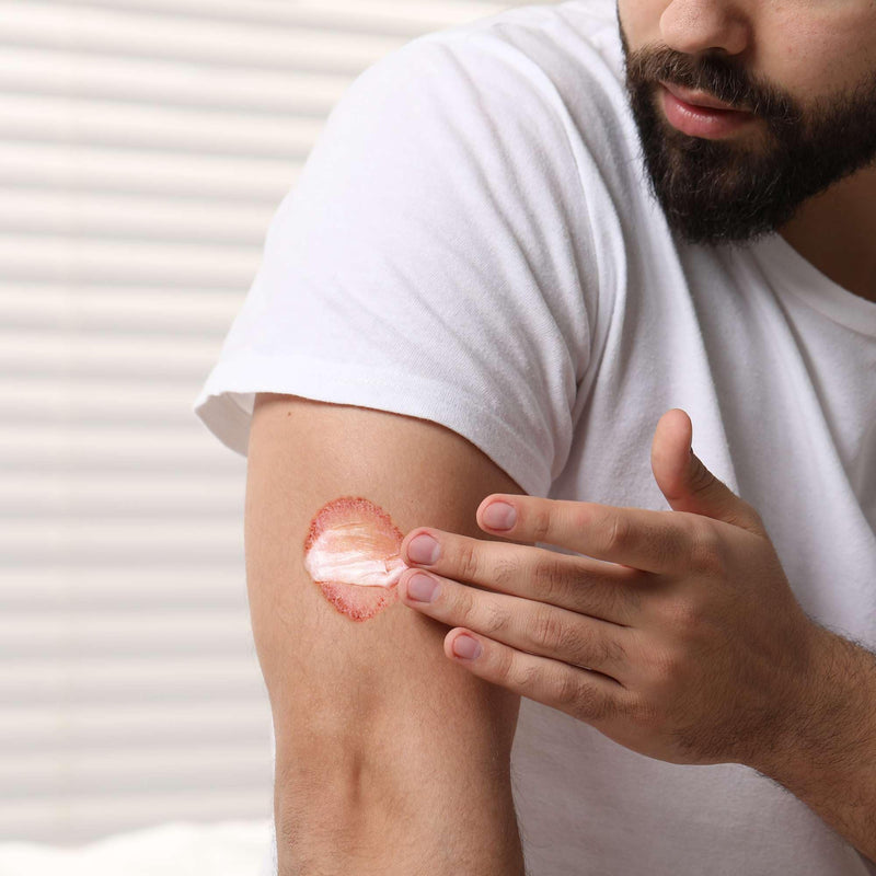 [Australia] - Miconazole Antifungal Cream for Skin - 4 oz of Miconazole Nitrate for Jock Itch, Athlete's Foot, Itching, and Ringworm 1 Pack 