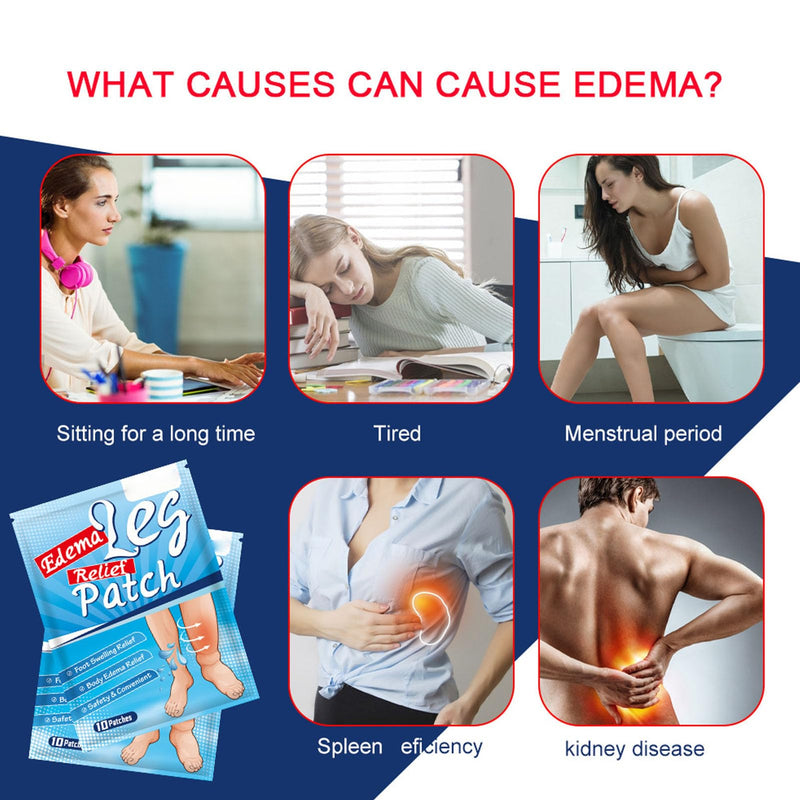 [Australia] - 50pcs Leg Edema Relief Patch Safe Herbal Extract Foot Leg Swelling Relief Patch Healthcare Leg Swelling and Foot Care 