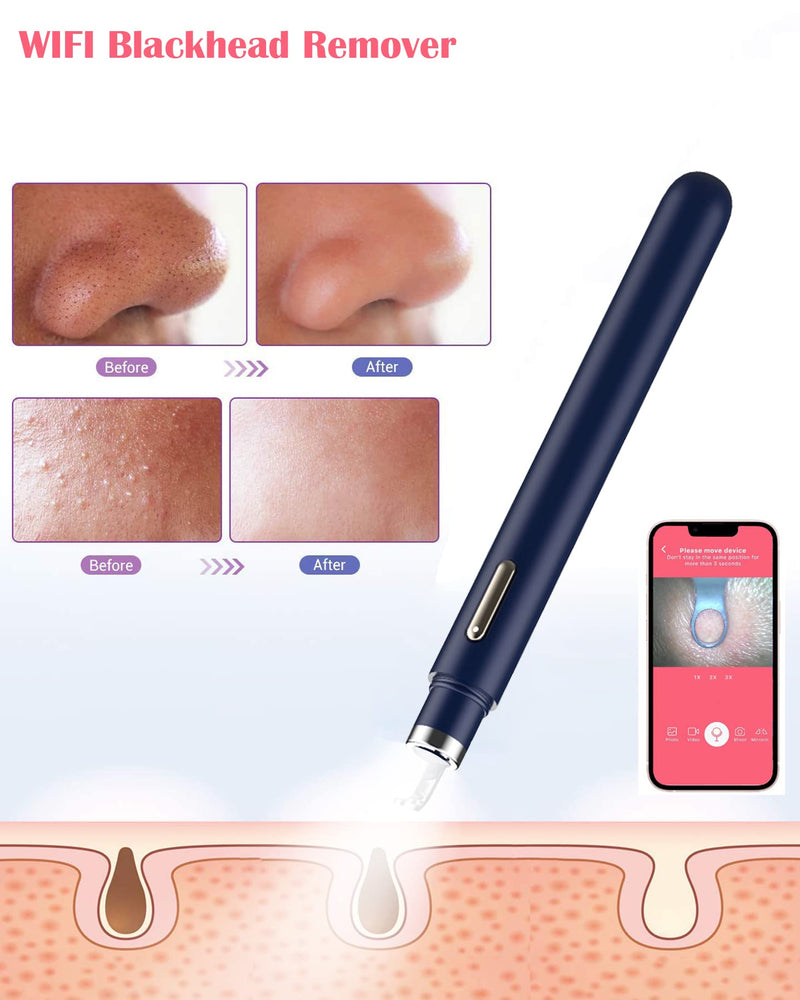 Blackhead Remover Tools with Camera Visible Pore Cleaner Waterproof Acne Comedone Whitehead Extractor Kit for iPhone/Android