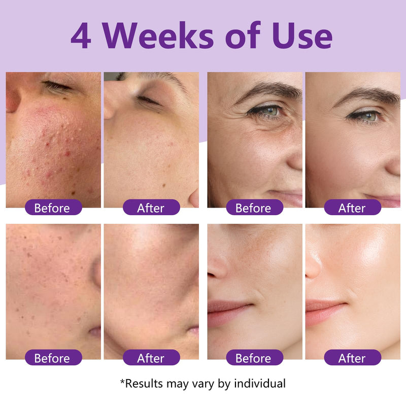 Hyaluronic acid essence contains vitamin B5 and ceramide to moisturize and repair skin barrier, improve the appearance of dry and fine lines (Skin Renewing Retinol Serum)