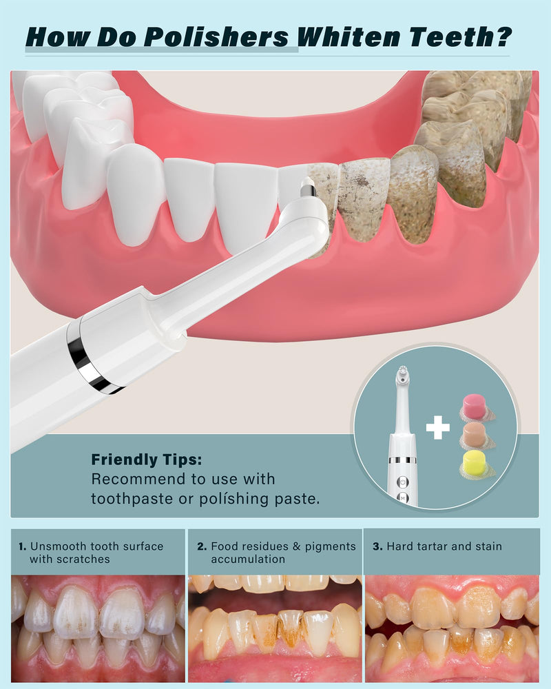 [Australia] - Tooth Polisher, Rechargeable Tooth Whitening Kit for Teeth Cleaning and Whitening, with 3 Tooth Polish Paste and 5 Brush Heads, LED Light, Easy to Use at-Home Personal Dental Care Kit White 