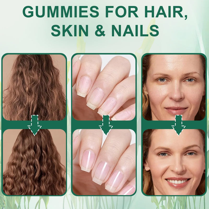 Hair Loss Gummies,Sea Moss Gummies with Vitamin C, Vitamin E, Aloe Vera, Pearl Powder Support Faster Hair Growth,Enhance Nail Elasticity,Promot Radiant Skin,Gluten-Free - 60 Count