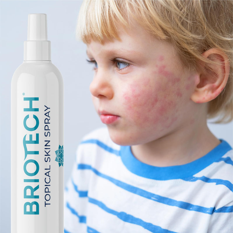 [Australia] - BRIOTECH Topical Skin Spray, Hypochlorous Acid Spray for Body & Face, Eyelid Cleanser, HOCl Facial Mist, Support Against Irritation, Calm Redness, Soothe Foot & Scalp, Packaging May Vary, 3.4 oz, 1 ct 3.4 Fl Oz (Pack of 1) 