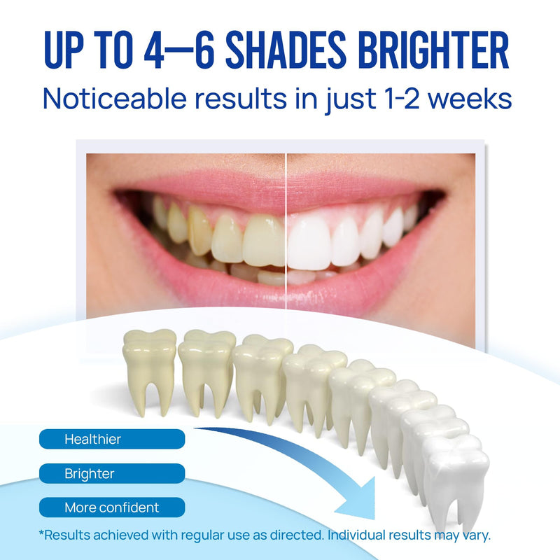 [Australia] - Teeth Whitening Pen Gel Kit: 35% Carbamide Peroxide Gel for Stain Removal - No Sensitivity with Remineralizing Pen for a Brighter Whiter Smile Mint (5 Pack) 