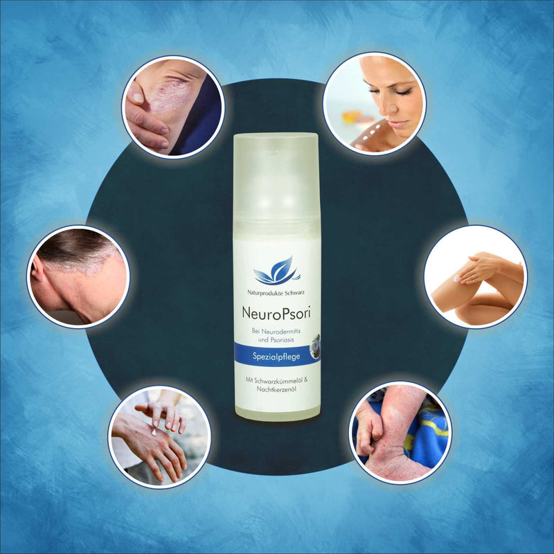 [Australia] - Natural Products Black - NeuroPsori Special Care Cream for Psoriasis/Psoriasis and Neurodermatitis, 50ml 50ml (Pack of 1) 