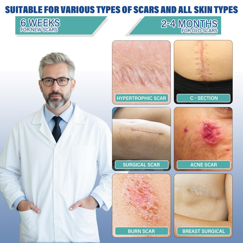 [Australia] - Silicone Scar Sheets,Silicone Scar Tape(1.6"x 158" Roll-4 meters),Silicone Scar Sheets for Surgical Scars,Keloid Bump Removal,Scar Tape for Surgical,C-Section,Tummy Tuck,Keloid Scars 