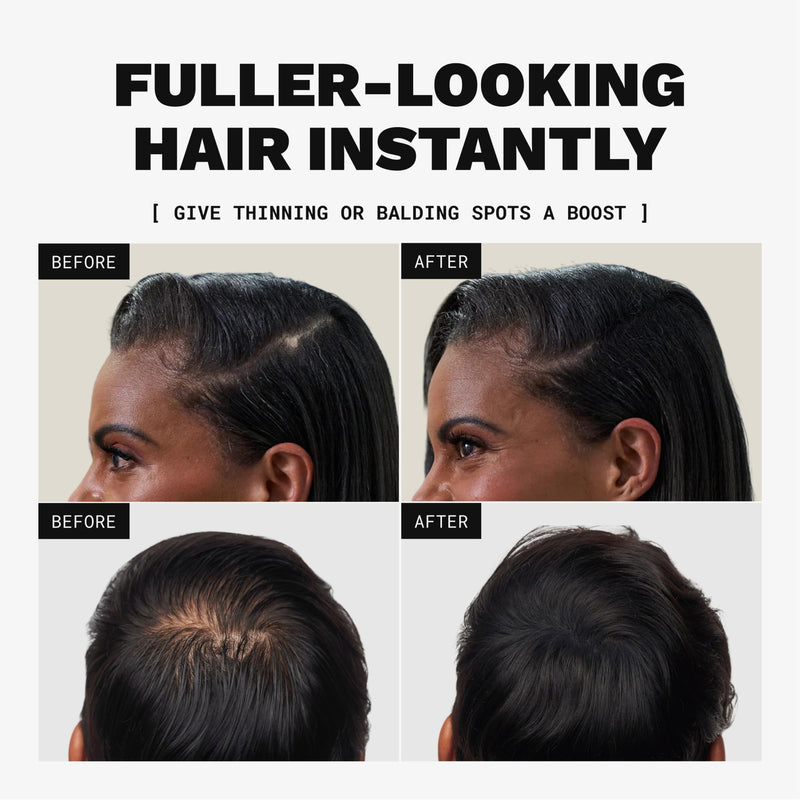 Toppik Hair Building Fibers, Fill In Fine or Thinning Hair Instantly Thicker, Fuller Looking Hair 9 Shades,4 size options Dark Brown Medium 12g