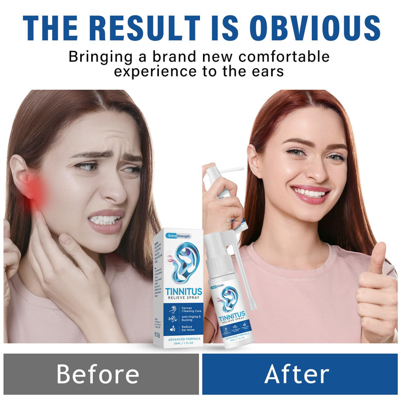[Australia] - Tinnitus Relief for Ringing Ears, Natural Tinnitus Relief Spray, Tinnitus Treatment for Ear Noise & Tinnitus Interference, Improves Hearing for Women Men Blue/Tinnitusreliefspray 
