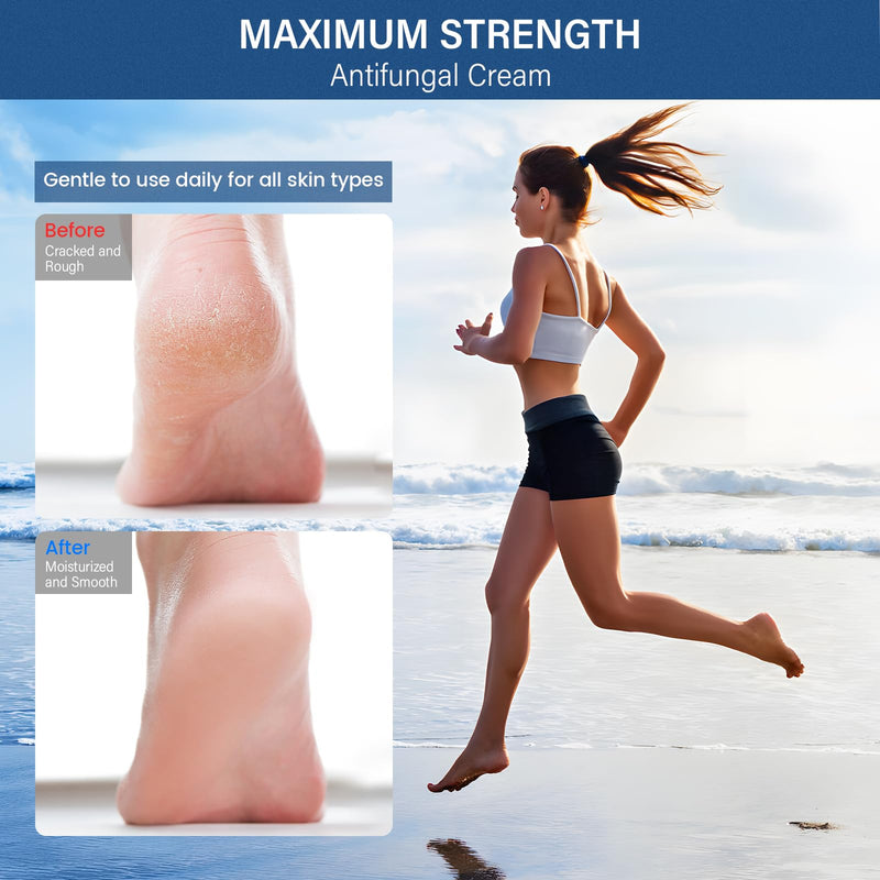 [Australia] - Skin fungus cream, athlete's foot cream with tea tree oil and herbal extracts, Expertcare fungicide for the treatment of athlete's foot and psoriasis - against itching, soothes, inflamed & dry skin 30 ml 