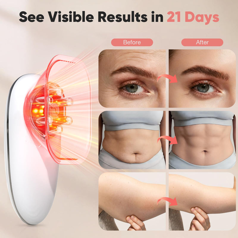 3-in-1 Electric Cellulite Massager, 3-in-1 Body Sculpting Machine for Stomach, Waist, Arms, Legs, Handheld Adjustable Cellulite Massage Tool, Skin Tightening Tool for Women and Men, White