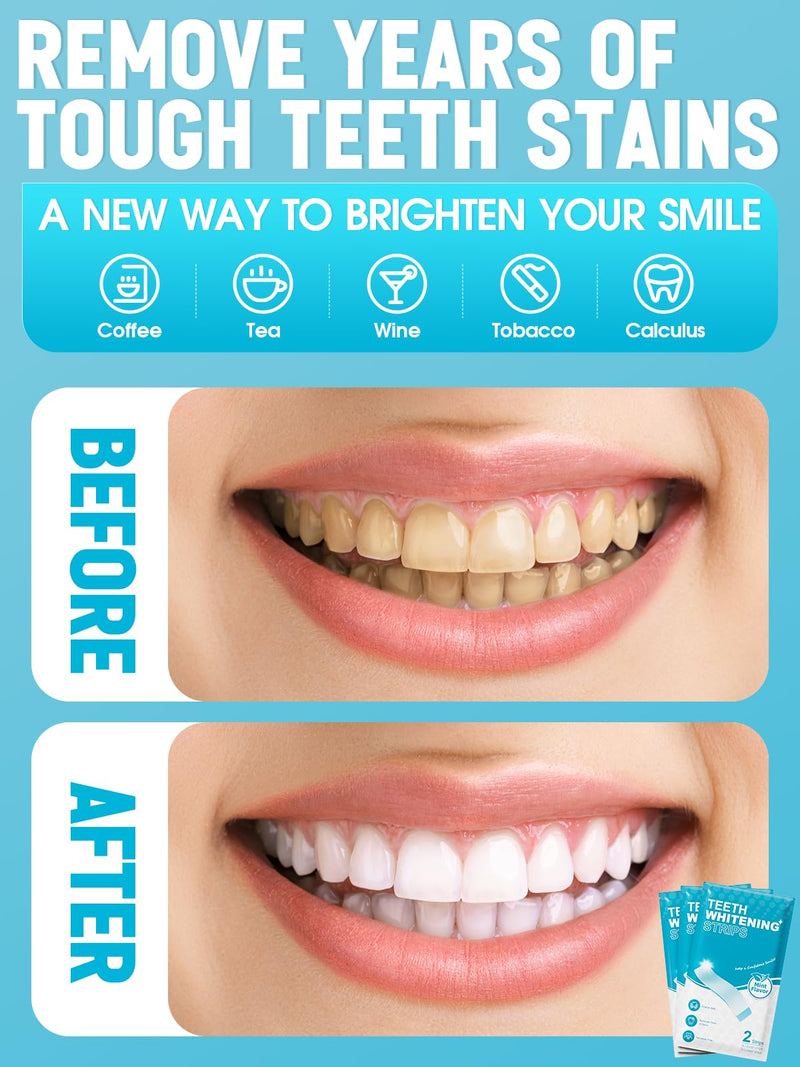 [Australia] - Oralfree Natural Teeth Whitening Strips - Sensitive Teeth Whitener - Enamel Safe Teeth Whitening Kit with Hydrogen Peroxide for Coffee, Wine, Tobacco, and Other Stains, 28 Strips (14 Treatment), Mint Gradient Blue 
