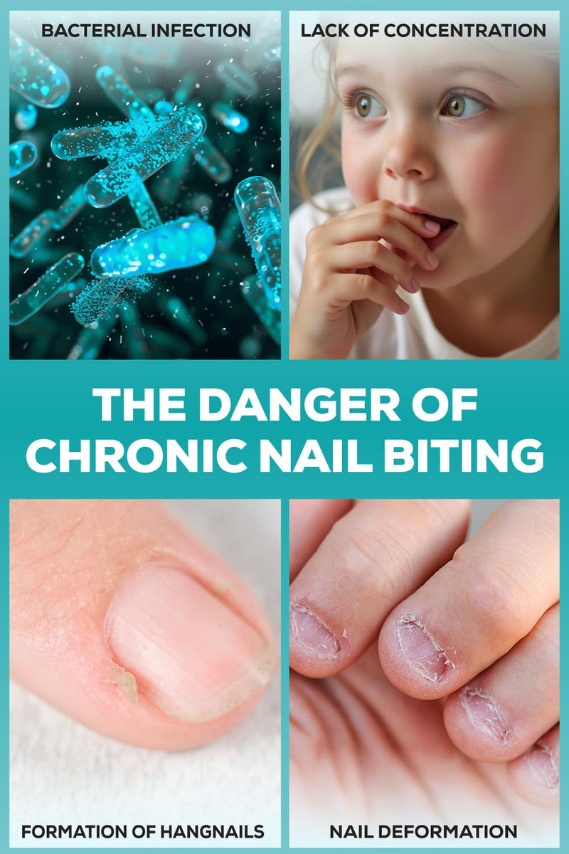 [Australia] - Nail Biting Prevention for Kids - Thumb Sucking Deterrent for Kids, Toddlers, Children - No Bite Nail Polish Pen - Bitter Taste - Safe & Effective Solution for Age 3+ 0.14 Fl Oz (Pack of 1) 