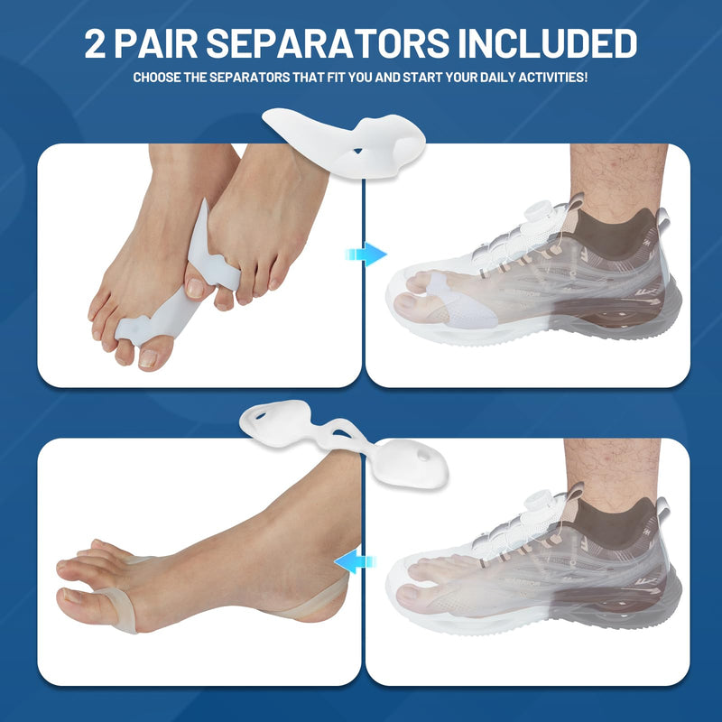 [Australia] - Bunion Corrector for Women & Men with Infinitely Adjustable Knob, Orthopedic Bunion Splint for Big Toe Suitable for Left/Right Feet Hallux Valgus Relief (1PCS) 