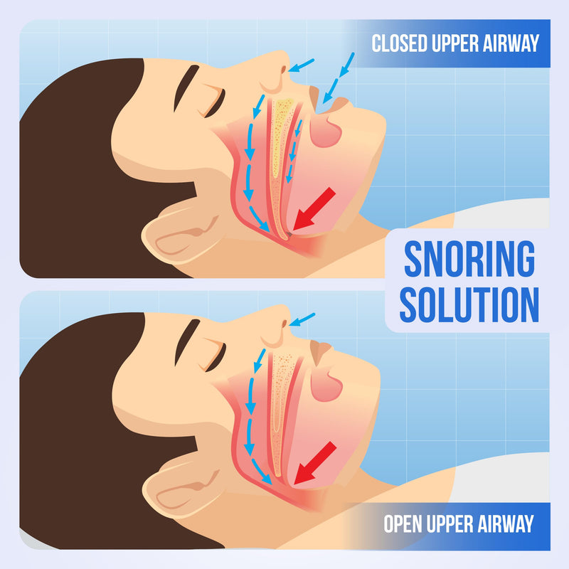 [Australia] - Chin Strap for Sleeping, Built-in Neck Cushions for Comfort, Works for CPAP Users, Snore Jaw Straps for Sleep, Mouth Breathing, Chin Lifting, Anti Snoring Devices, Men and Women, Black, M 
