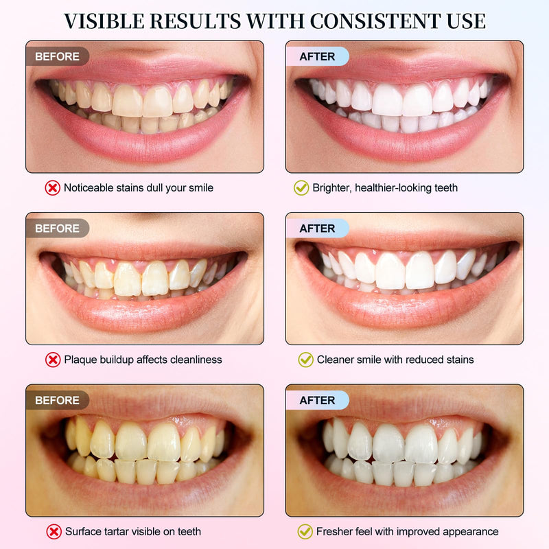 Niacinamide Whitening Toothpaste, 2 Pack Intensive Stain Removal Toothpaste for Yellow Teeth, Gum Care, Fresh Mint & Peach Breath, Tartar Control, Deep Clean for Men and Women, 3.5oz 3.8 Fl Oz (Pack of 2)