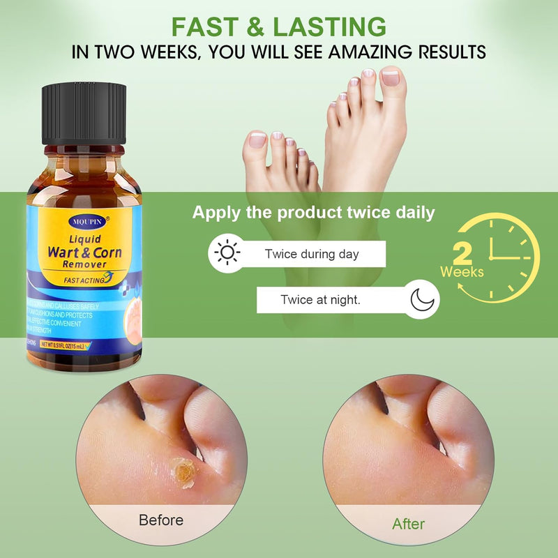 [Australia] - MQFORU Corn Remover, Corn Removers for Toes, Callus Remover for Fast-Acting Foot Care - Plantar and Common Callus Remover 15ML (0.51 oz 15 pcs Pads) 