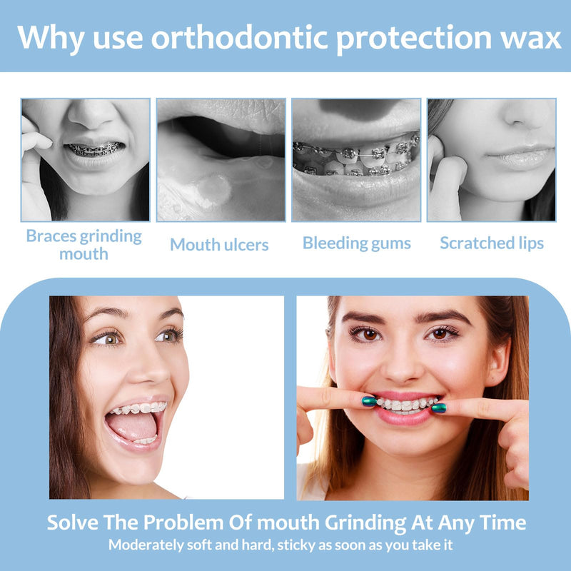[Australia] - Sularpek 10 pieces/50 strips orthodontic wax for braces, braces wax, orthodontic wax, dental wax for braces, braces wax to relieve irritation pain 