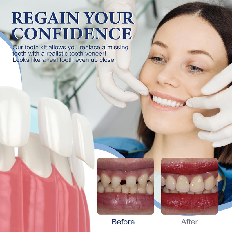 Tooth Repair Kit，Temporary Natural Shade for Filling The Gap, Moldable Thermal Beads Replacement Kit Replace The Missing or Broken Tooth-6PCS-T003