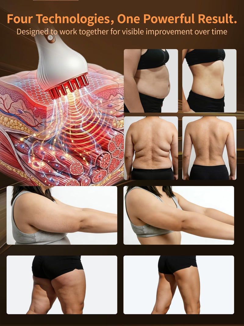 Lymphatic Drainage Massager for Full Body, Body Sculpting Machine & Cellulite Massage Tool for Skin Smoothing, – Relieves Muscle Tension, Reduces Cellulite, and Enhances Skin Firmness