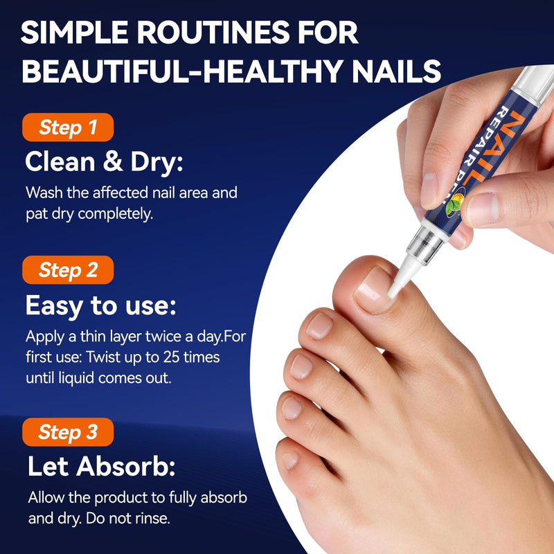 Toenail Fungus Pen, 25% Undecylenic Acid- Repairs Yellow Thick Brittle Toe and Fingernails - 5 Pens with 1 Nail Files