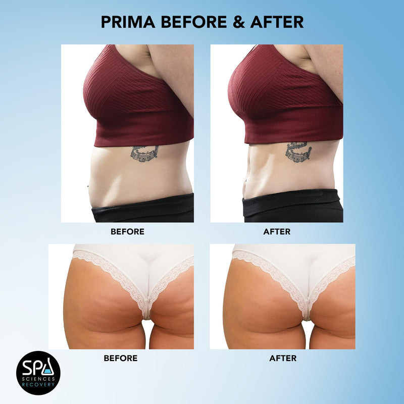 [Australia] - SPA SCIENCES - Prima - Therapeutic Body Massager for Cellulite Reduction, Body Contouring, Relaxation & Recovery with 4 Interchangeable Heads 
