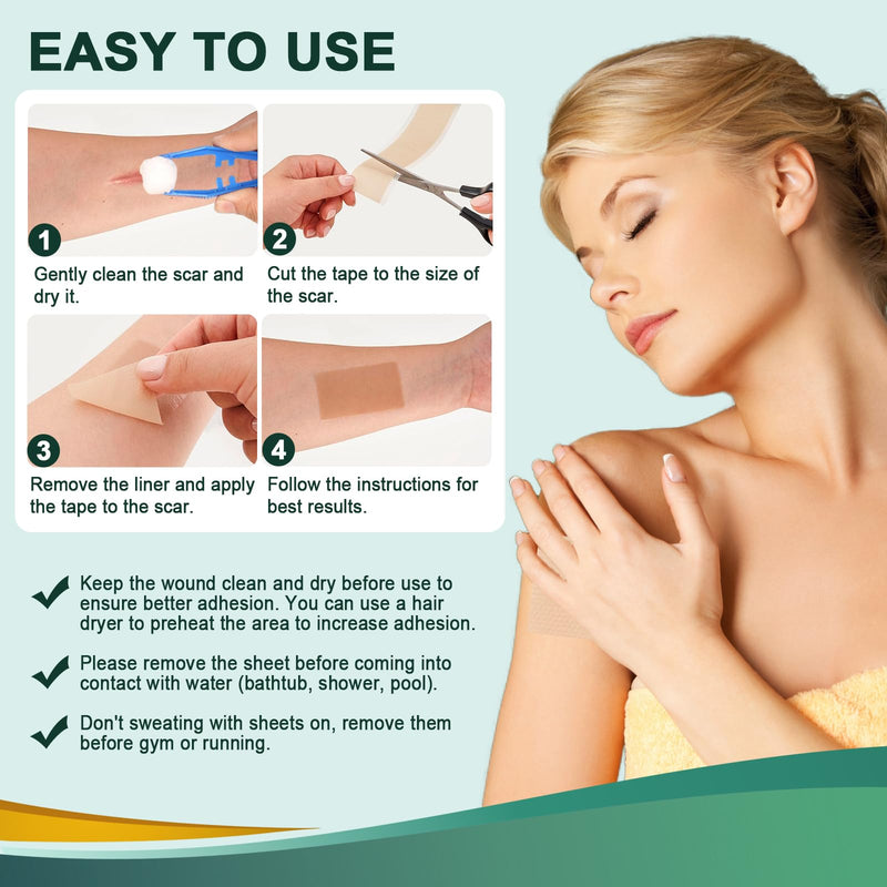 [Australia] - Silicone plaster for scars, professional scar plaster, reusable (4cm x 150cm) 4cm x 150cm 
