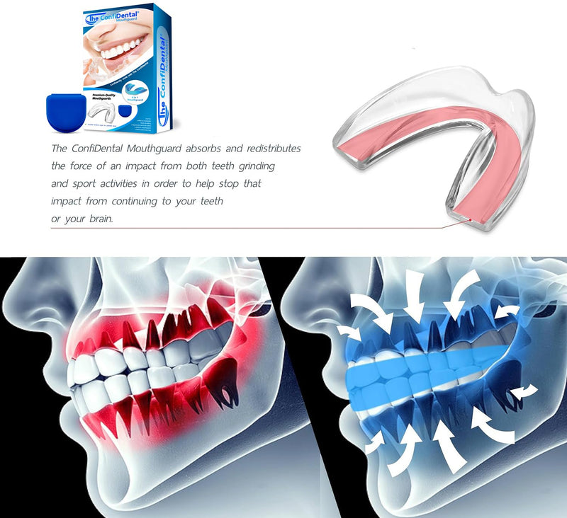 [Australia] - The ConfiDental - Pack of 3 Moldable Mouth Guard for Teeth Grinding Clenching Bruxism, Sport Athletic, Whitening Tray, Including 2 Regular and 1 Heavy Duty Guard (2 (LLL) Regular 1 (II) Heavy Duty) Model I (2pcs.) + Medel III (1pcs.) Blue 3 