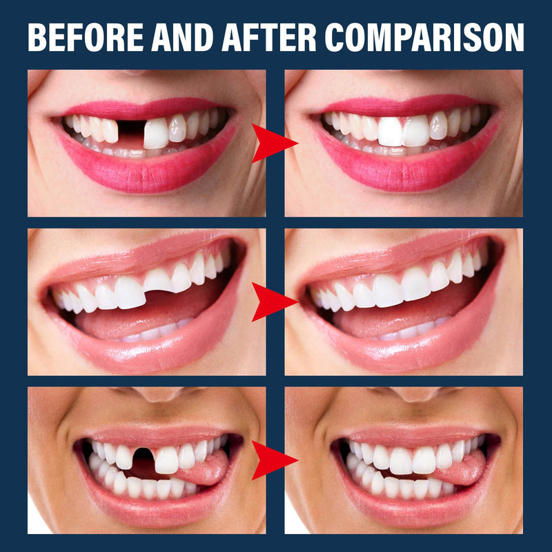 [Australia] - 84 Pcs False Teeth Dental Complete Acrylic Resin Denture Teeth, 3 Sets Whole Teeth Synthetic Polymer Denture Tooth, 23 Shade A2 Upper + Lower Dental Materials for Replacement, DIY or Halloween 