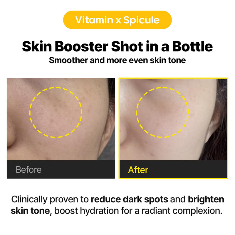 Cell Fusion C Toning C Vita Shot Ampoule, Brightening Vitamin C Serum for Face with Spicules, Zero Dark Spots & Glow Serum for Sensitive Skin, 20g / 0.7 oz.