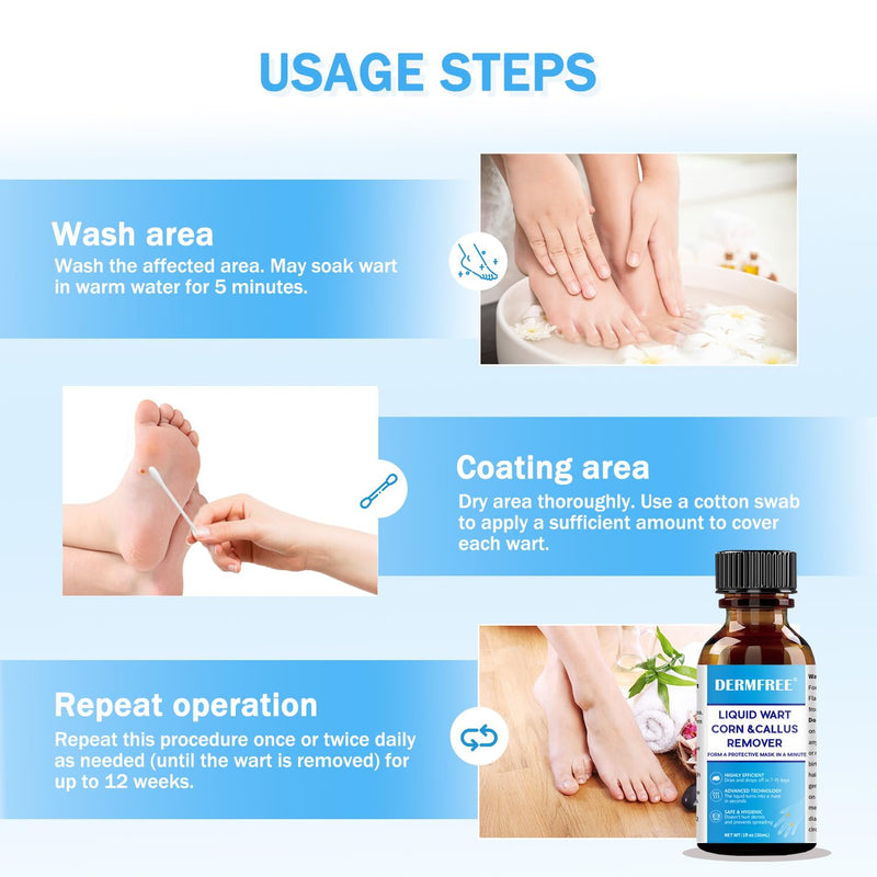 [Australia] - LIGUID WART Remover,Fast Action Wart Remover,Wart Liquid with Salicylic Acid, Plantar Wart, Common Wart, Flat Wart,Corn, Callus,1floz(30mL) 1 bottle 