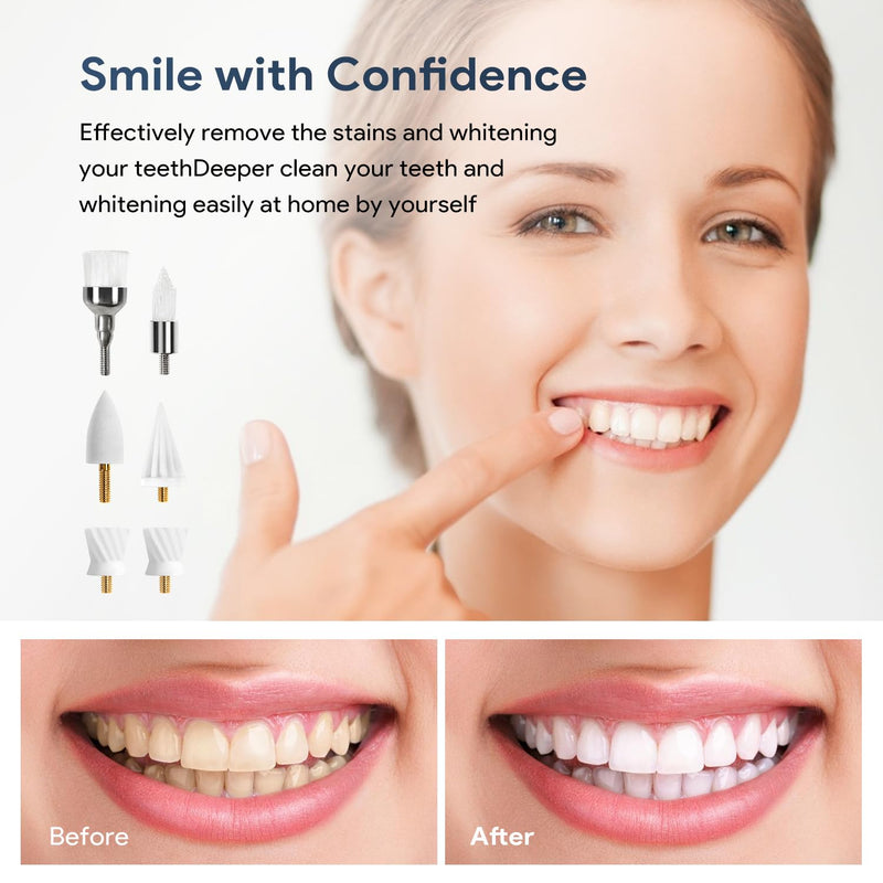 6 Tooth Polisher Replacement Brush Heads,Tooth Cleaning Replacement Set for Daily Tooth Cleaning,Whitening and Polishing for Electric Tooth Polishers