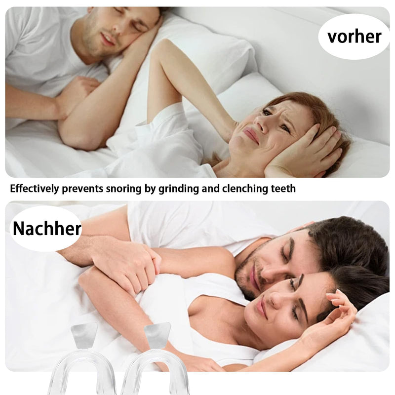 [Australia] - Thoquene Pack of 4 nighttime grinding splints, 2 sizes, grinding splints with whitening tray 