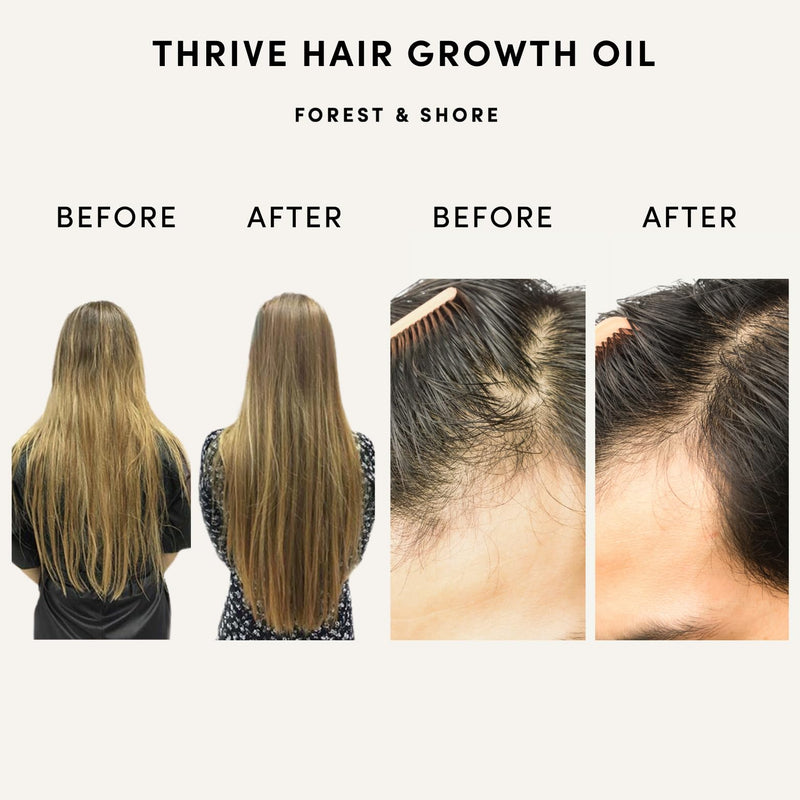 Forest & Shore Hair Growth Oil, 100% Natural, with Caffeine, Biotin, Castor , Argan & Rosemary, Effective Serum for Damaged Hair Thrive Hair Oil
