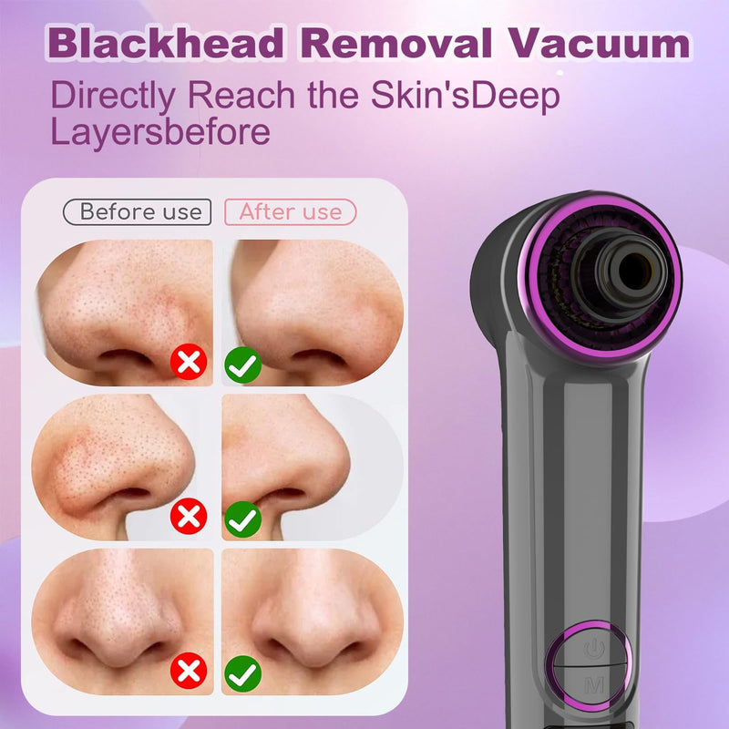 Blackhead Remover Pore Vacuum with Hot Compress, Upgraded Facial Pore Cleaner, Pore Extractor Acne White Heads Removal Tool- 9 Suction Power, 5 Probes Blackhead Vacuum Kit for Women & Men 1 Count (Pack of 1)