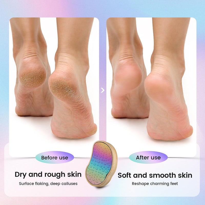 [Australia] - BEZOX Foot File and Callus Remover (New Upgrade) - Foot Rasp, Pedicure Dead Skin Removal Tool, Foot Scraper, Surgical Stainless Steel File and Comfortable Wooden Handle Rainbow Colors 