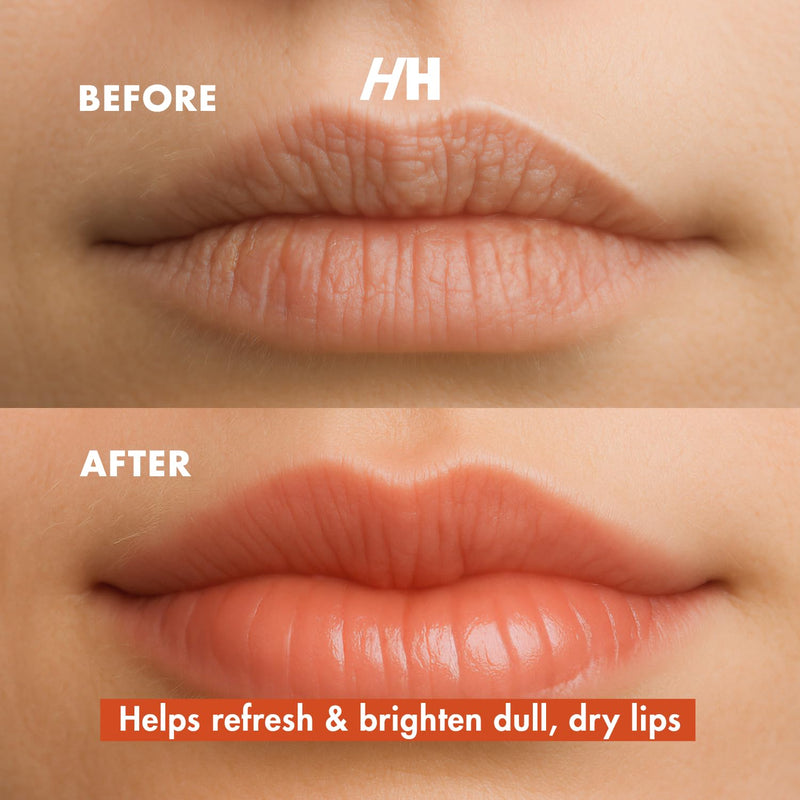 [Australia] - Handmade Heroes Turmeric Lip Scrub with Vitamin C ‚Äì 100% Natural Vegan Exfoliant for Dark Dry Chapped Lips ‚Äì Deep Conditioning Sugar Polish 1oz 