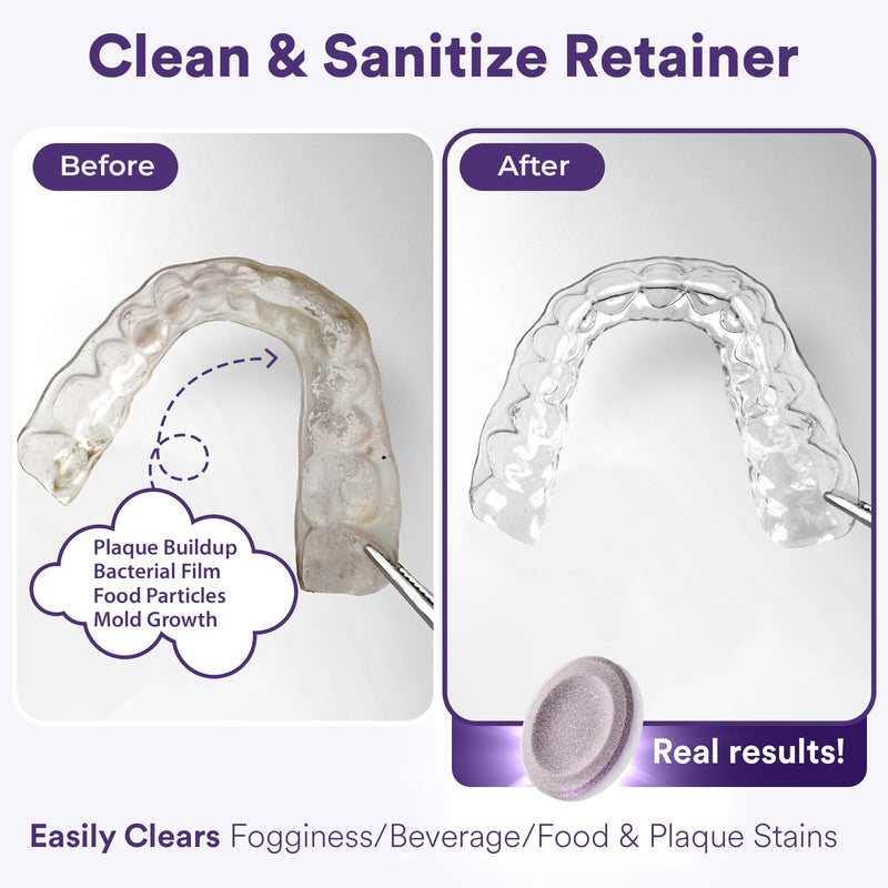 [Australia] - Weiss Naturals Retainer Cleaner Tablets, Invisalign Cleaner, Remove Stains, Odors & Plaque, PERSULFATE FREE Night Guard & Denture Cleaner 2-Month Supply, 60 Grape Scented Tablets 60 Count (Pack of 1) 