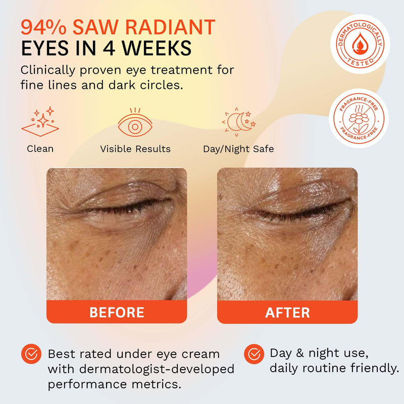 Fig.1 Vitamin C Eye Cream for Dark Circles, Puffiness & Wrinkles | Under Eye Cream for Women & Men | Glowing Eye Treatment | Refillable Anti Aging Moisturizer for Fine Lines Starter Kit 0.5 Fl/Oz