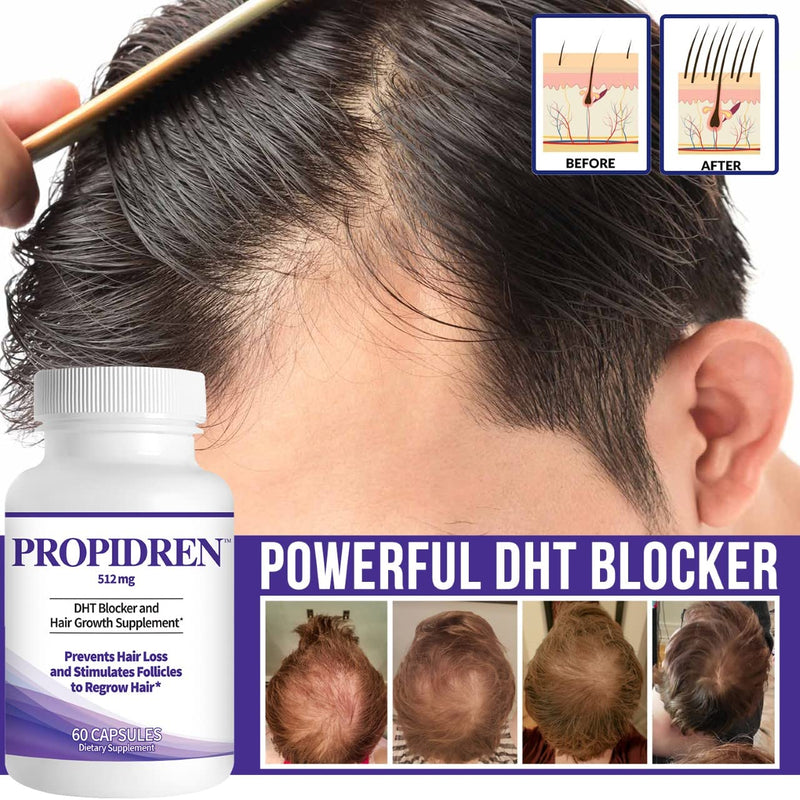 Propidren DHT Blocker & Hair Growth Pills To Stop Hair Loss and Regrow Hair | Hair Vitamins for Men & Women, Regrowth, DHT Blocking, Thinning Hair, Excessive Shedding, Scalp Support, 30 Day Supply