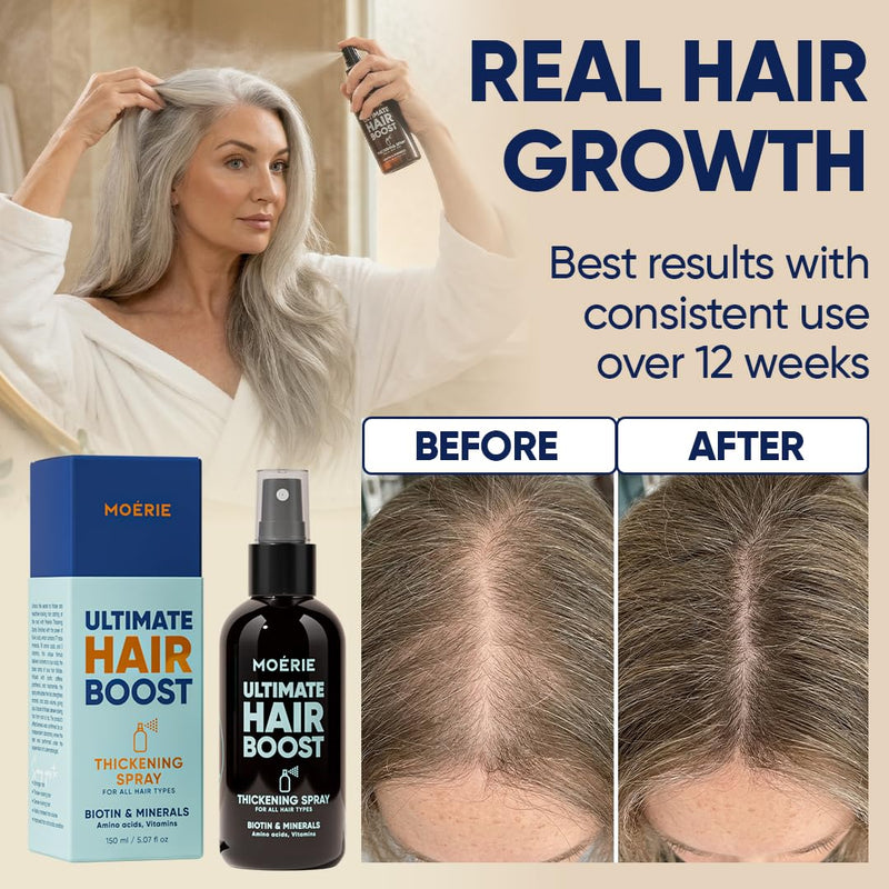 Moerie Hair Growth Serum Spray for Men and Women, Hair Loss Solution with Biotin and Rosemary, Thickening Serum for Hair Regrowth and Thinning Hair - Ultimate Scalp and Growth Care Single Set