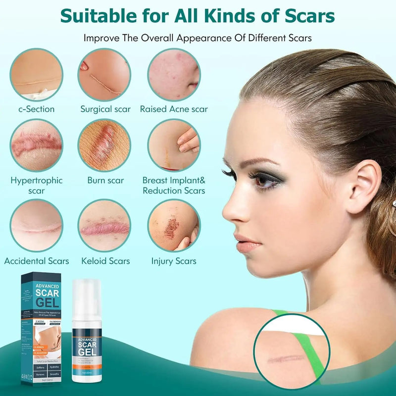 Silicone Scar Cream Scar Gel - Advanced Scar Gel Scar Treatment for Stretch Marks Removal, Old & New Scars, Surgical Scars, Burns, Acne, C-Section, Keloid Scar Treatment for Women & Men, 1.76Oz