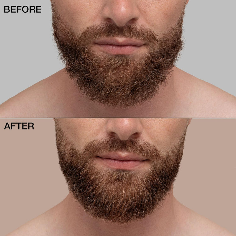 [Australia] - vinsk® Premium Beard Oil Men [30ml] for three-day stubble to full beard | 100% natural beard oil for a soft & radiant beard | Moisturizing Beard Softener I Beard oil for Men 