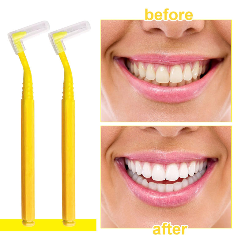 [Australia] - SKHAOVS Pack of 40 L-shaped interdental brushes, dental brushes, tooth cleaning between spaces, interdental space cleaner, brushes for interdental spaces, tooth sticks for teeth cleaning, braces cleaning (yellow) yellow 