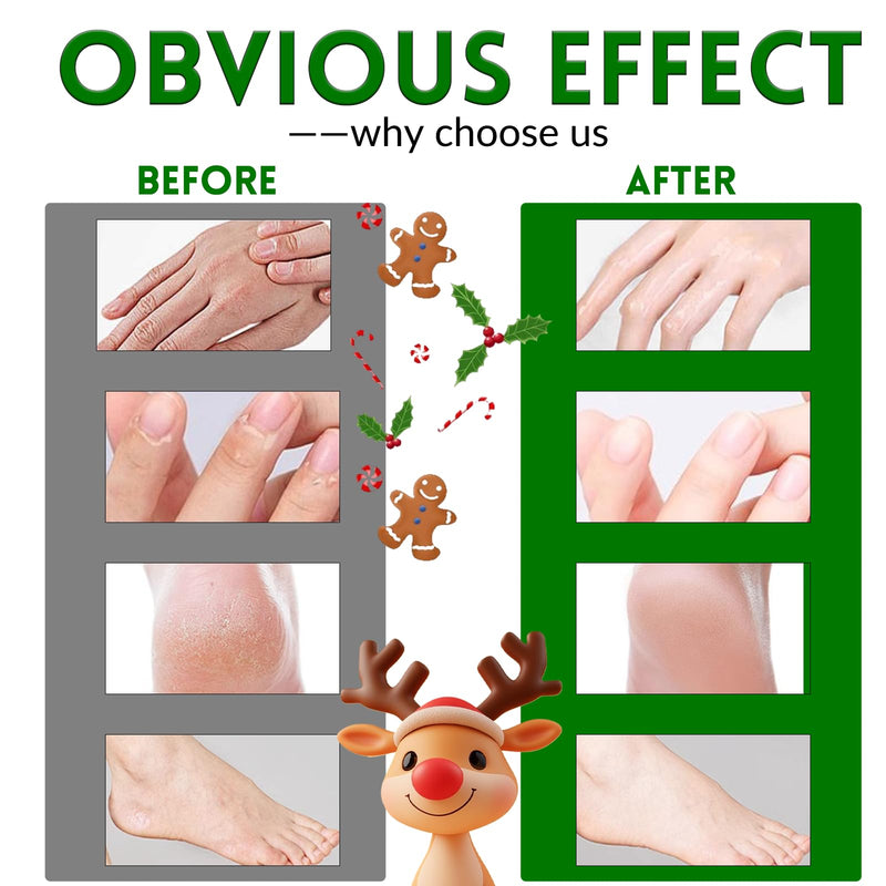 [Australia] - Foot Mask Hand Mask Christmas Gifts Hydrating Moisturizing 12 Packs Gloves & Socks Intensive Repairing Masks Peeling Mask for Women Dry Cracked Set Coconut Oil Tea Tree Extract Elitzia ETXJ2409 Rose+Tea Tree 