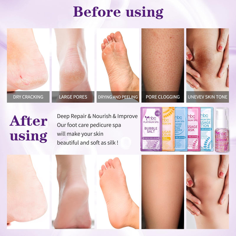 [Australia] - Pedicure Foot Soak Set - Upgraded 6 in 1 Foot Spa, Foot Bath Spa, Pedicure Kit for Tired & Dry Cracked Feet, Athletes Feet, Bad Odor, Softens Calluses (3 Set Lavender) 3 Set Lavender scent 