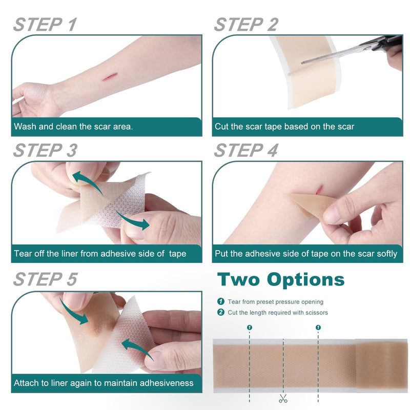 [Australia] - Silicone Scar Sheets (1.6"x 158" Roll-4M), Silicone Scar Tape for Scar Removal Treatment, Reusable Silicone Scar Strips for C-Section, Keloid, Burn, Acne, Surgical Scars 1.6"×158" 