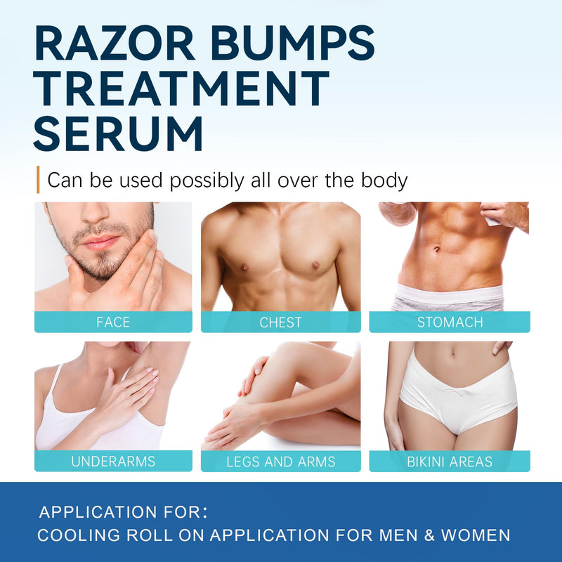 [Australia] - Morovan Razor Bumps Treatment: Ingrown Hair & Razor Burn Solution for Bikini Beard & Body for Women and Men 100ml 