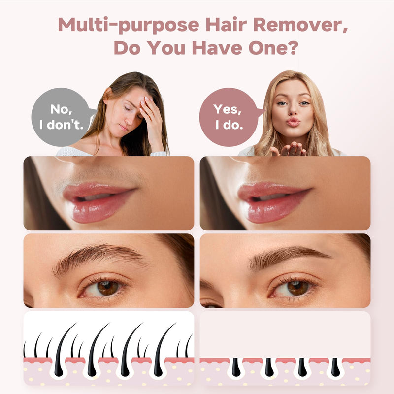 [Australia] - Facial Hair Remover for Women (Gen 3 Pro), 2024 Luxury Women's Beard Remover with Smartlight, guRelax Face Mini Hair Remover, for Face, Eyebrows, Fuzz, with 2 Flawless Replacement Heads Deluxe 2-in-1 White (2x Replacement Heads Included) 