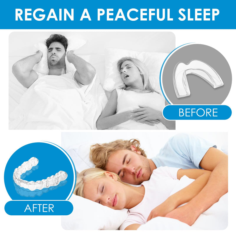 [Australia] - Pack of 4 nighttime grinding splints, 2 sizes, silicone tooth splint, mouth guard, bite splint, against bruxism, improves sleep quality, snoring splint, anti-snoring 